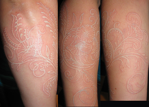 What to Know About Tattoo Lightening  Removery
